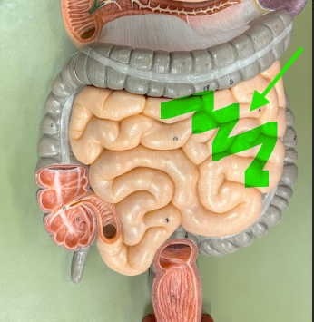 <p>What is the arrow pointing at?</p>