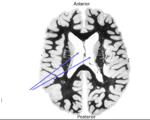 <p>Name the structure</p>