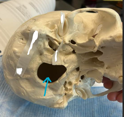 <p>ID skull hole region</p>