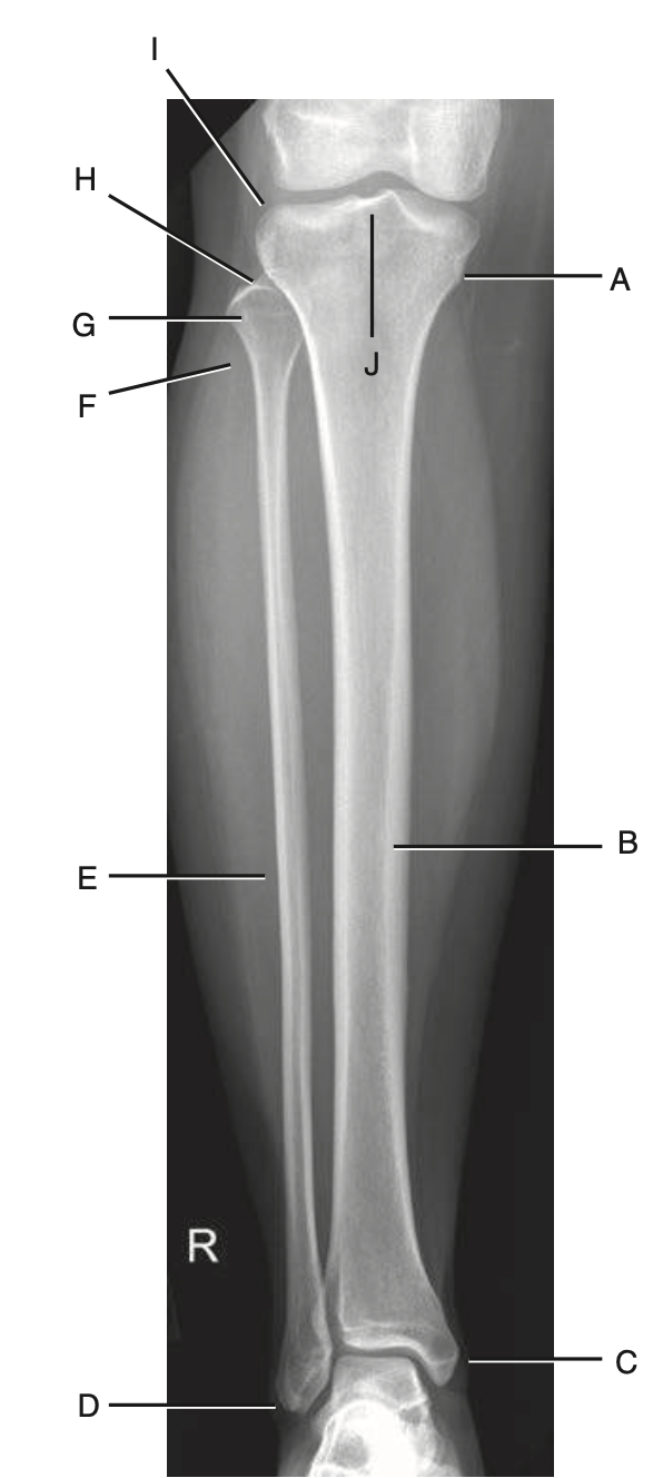<p>C</p>
