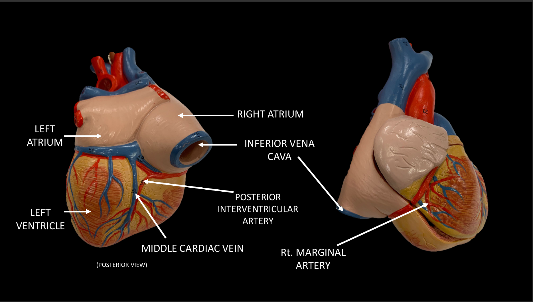 <p>MIDDLE CARDIAC VEIN</p>