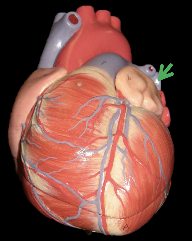 <p>Identify the structure </p>