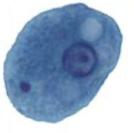 <p>What Amaeba is this?</p>
