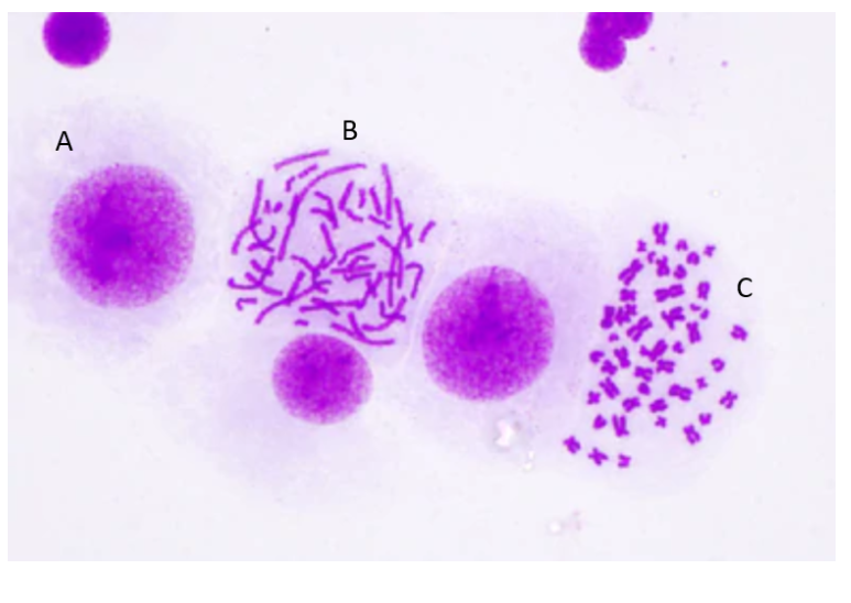 <p>what stages of mitosis are these?</p>
