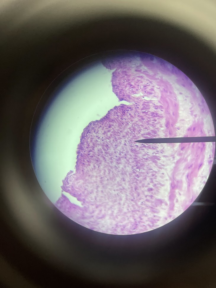 <p>structure name + layer name</p>