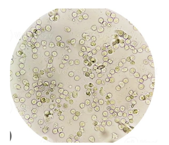 <p>seen in stool microscopic examination</p>