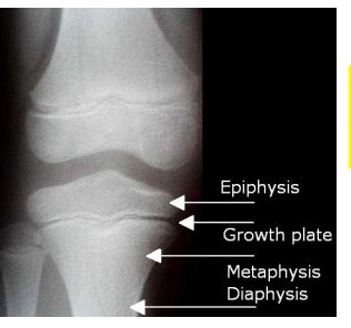 <p>Epiphyseal line on long bones</p>