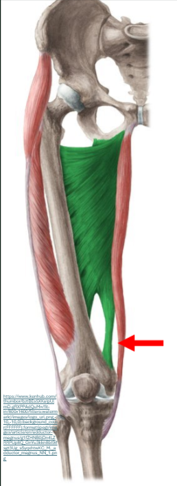 <p><span><strong>Origo pars inferior</strong>:</span><span style="line-height: 31px;"><br></span><span style="line-height: 0px;">tuber ischiadicum</span><span style="line-height: 31px;"><br><br></span><span><strong>Insertie: </strong></span><span style="line-height: 31px;"><br></span><span>tuberculum adductorium</span><span style="line-height: 0px;"> </span></p><p class="Paragraph WhiteSpaceCollapse SCXP90522934 BCX8" style="text-align: left;"><span style="line-height: 0px;"></span></p><p class="Paragraph WhiteSpaceCollapse SCXP90522934 BCX8" style="text-align: left;"><span><strong>Functie</strong>: </span><span style="line-height: 31px;"><br></span><span>art. Coxae:</span><span style="line-height: 31px;"><br></span><span>* <em>adductie</em></span><span style="line-height: 31px;"><br></span><span>* retro<em>flexie</em></span><span style="line-height: 31px;"><br></span><span>* <em>endorotatie</em></span></p><p></p>