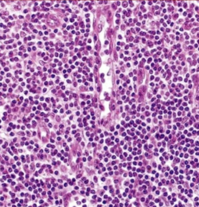 <p>What is that gap in the cells in the lymph node is this?</p>
