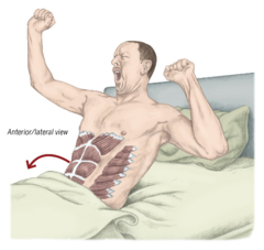<p>rectus abdominis</p><p>sitting up after a long night's rest</p>