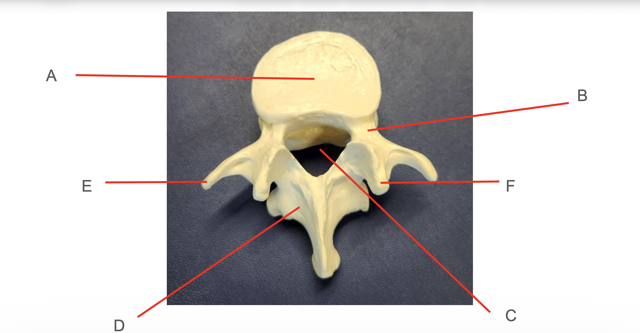 <p>Identify Structure D</p>