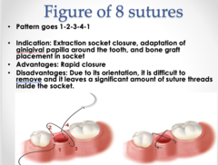 <p>When there is no primary closure of flaps; holds flap more apically than coronally.</p><p>(Explanation: The figure eight suture is used when flaps cannot be fully approximated, such as in apically positioned flaps, securing them lower on the tooth to maintain position during healing.)</p>