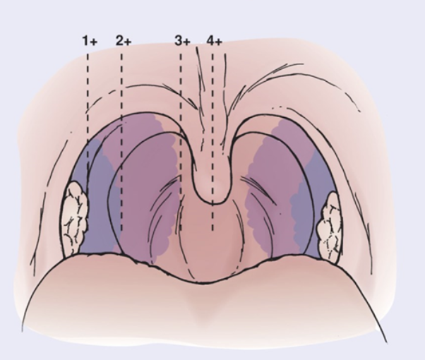 <p>visible</p>