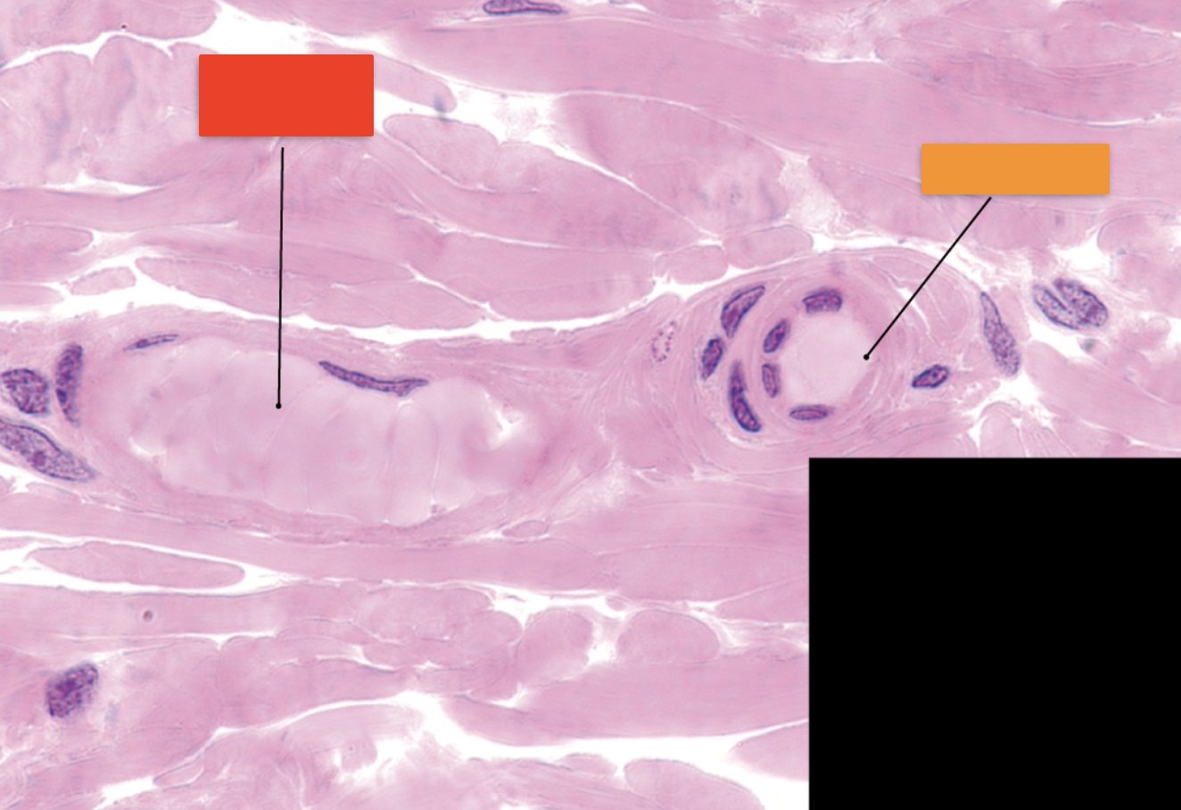 <p>Classify the structure indicated by the orange box</p>