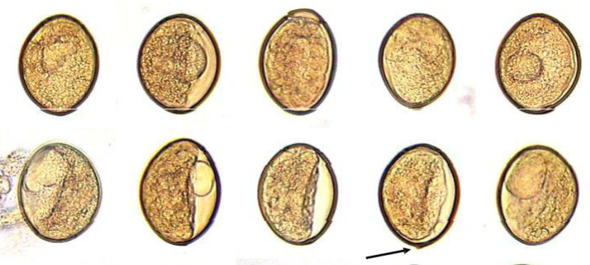 <p>Keywords for Diphyllobothrium latum</p>