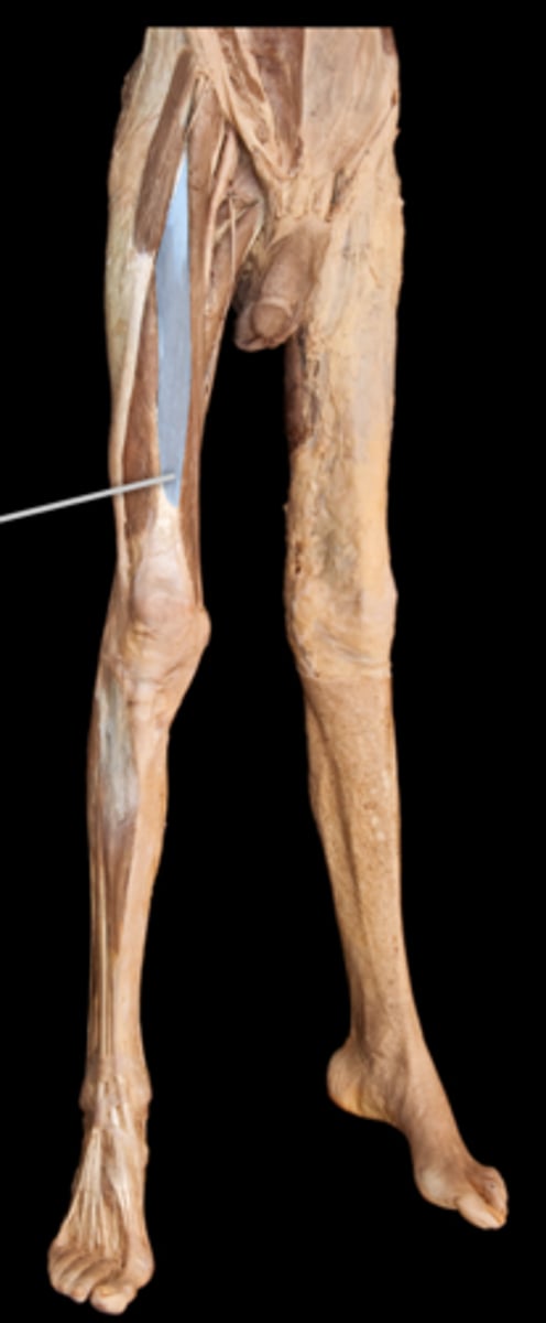 <p>What muscle is this?</p>
