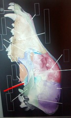 <p>Bone? Plane of view?</p>