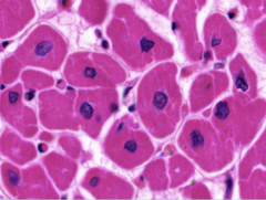 <p>Identify</p>