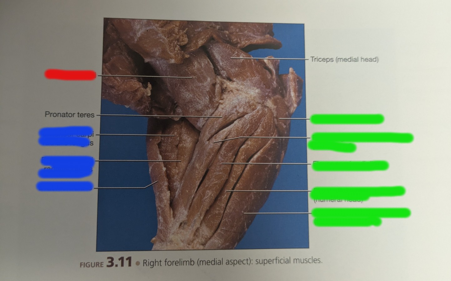 <p>In red, looking left, Medial (underside), forelimbs</p>
