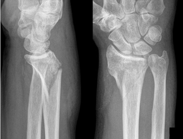 <p>What is the diagnosis?</p>