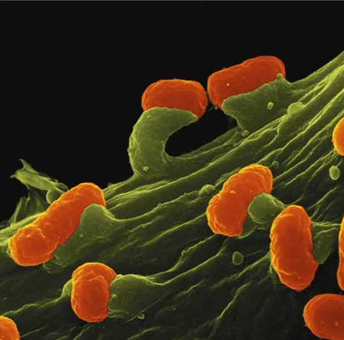 <p>Pathogen → EPEC, EIEC, EAEC, ETEC</p><p>Symptoms → Watery diarrhea</p><p>Intox/Infec → Infection (exotoxins)</p><p>Diagnostic Test → Isolation on selective media, DNA fingerprinting</p><p>Treatment → Oral rehydration</p><p>*Reservoir = cattle</p><p>*Causes the host cells to form pedestals where bacteria attach</p>