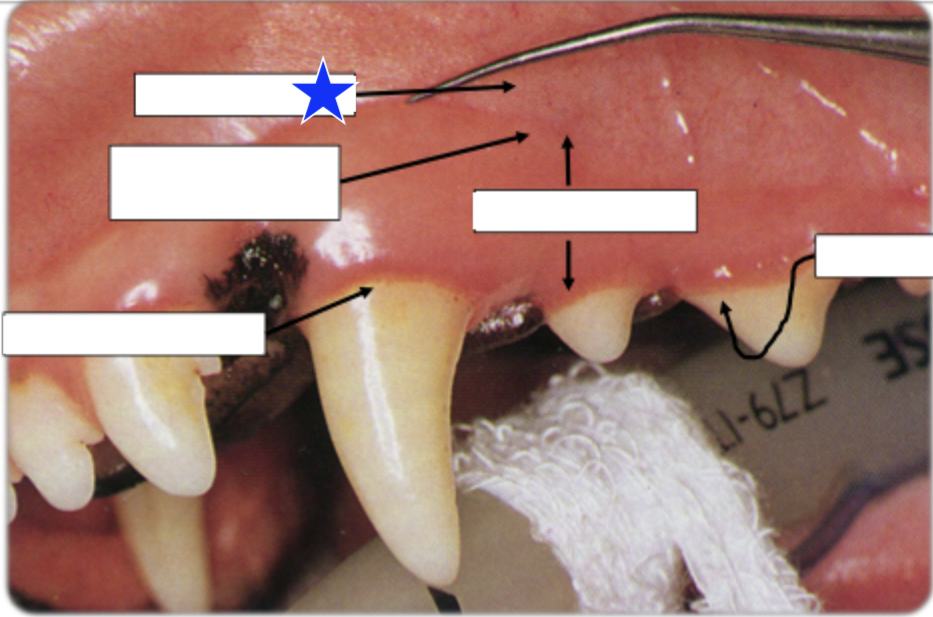 <p>What part of the gingiva is indicated by the star?</p>