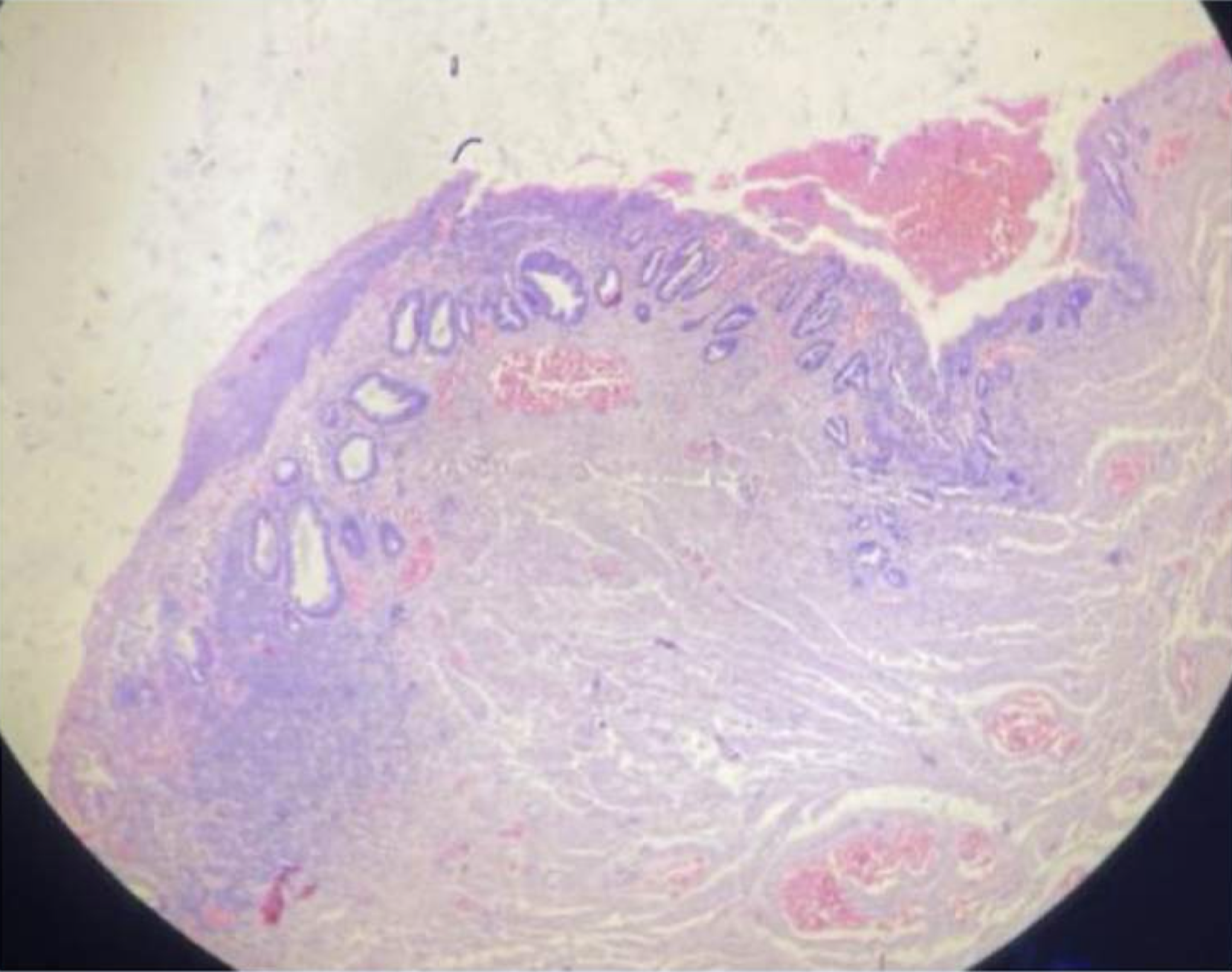 <p>Identify</p>