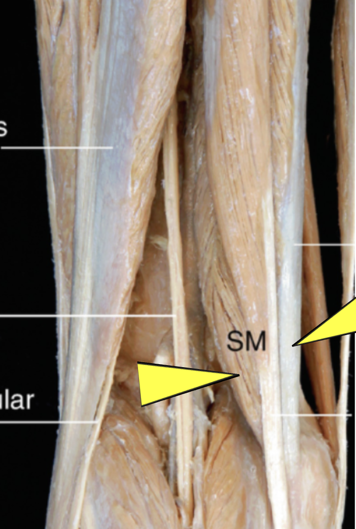 <p>ID muscle </p>