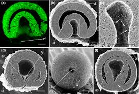 <p>deuterostome characteristics</p>