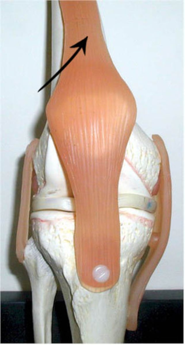 <p>Quadriceps Femoris Muscle Group</p>