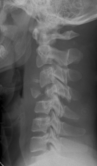 <p>What is the diagnosis?</p>