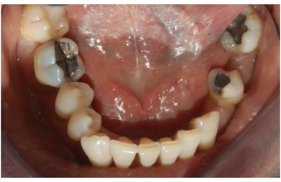 <p>CHẨN ĐOÁN?</p>