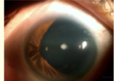 <p>Describe and give diagnosis </p>