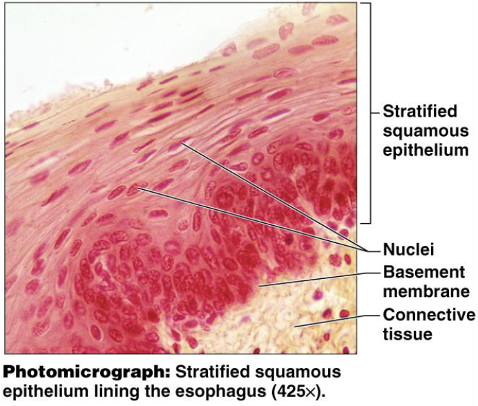 <p>Pic: esophagus</p><p>Skin’s epidermis (keratinized); linings of esophagus, mouth, and vagina (nonkeratinized)</p>