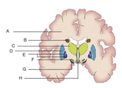 <p>Globus Pallidus</p>