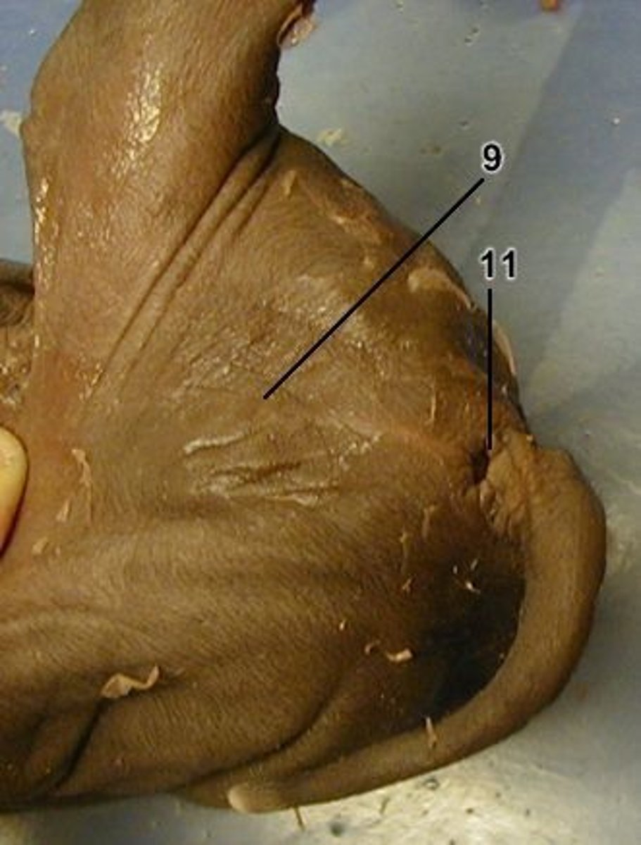 <p>9 = ?</p>