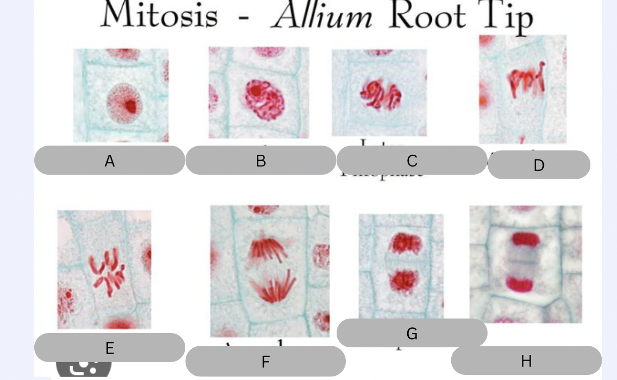 <p>What does figure B represent? </p>