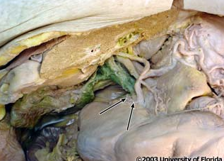 <p>what artery is being indicated to in the image?</p>