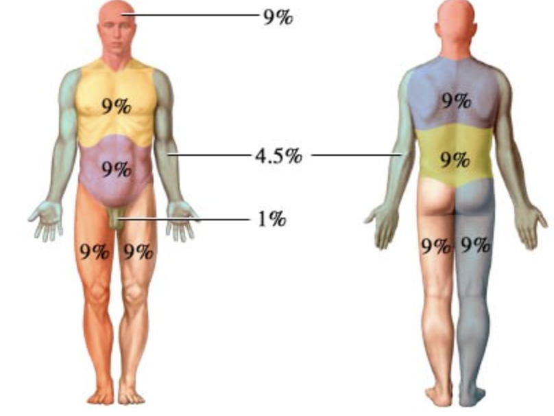 <p>Body divided into 9% sections (adult)</p>