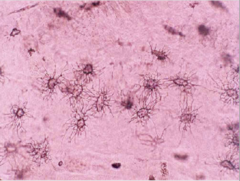 <p>What does this image show?</p>
