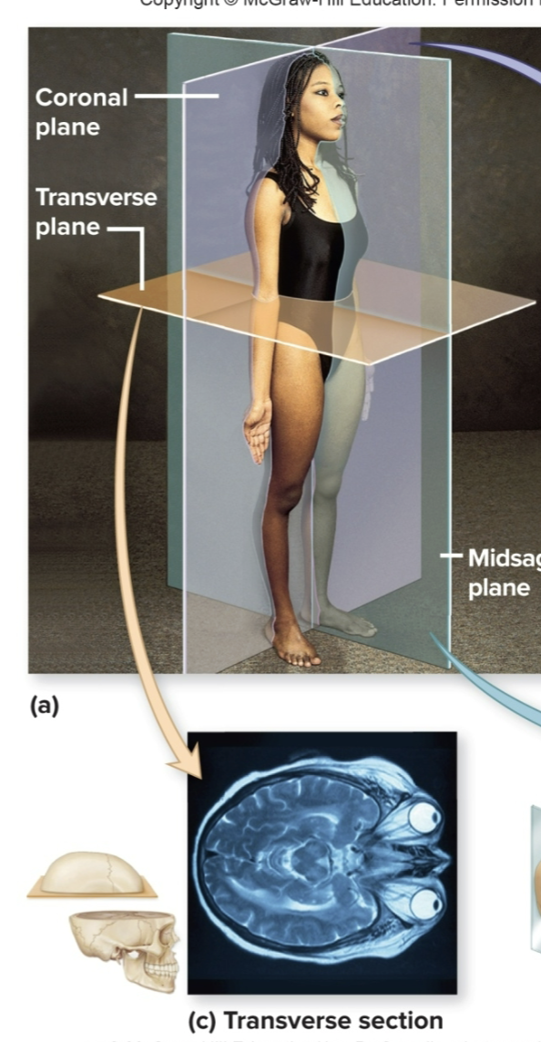 <p>divides body into superior/inferior sections</p>