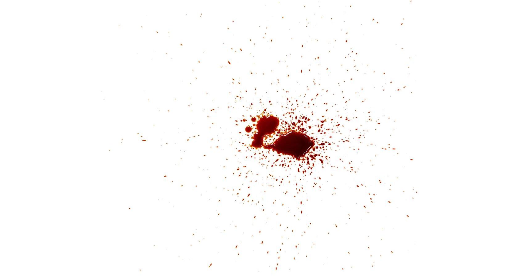 <p>Spatters are produced when a source of liquid blood travels through the air before landing on a target surface.</p>