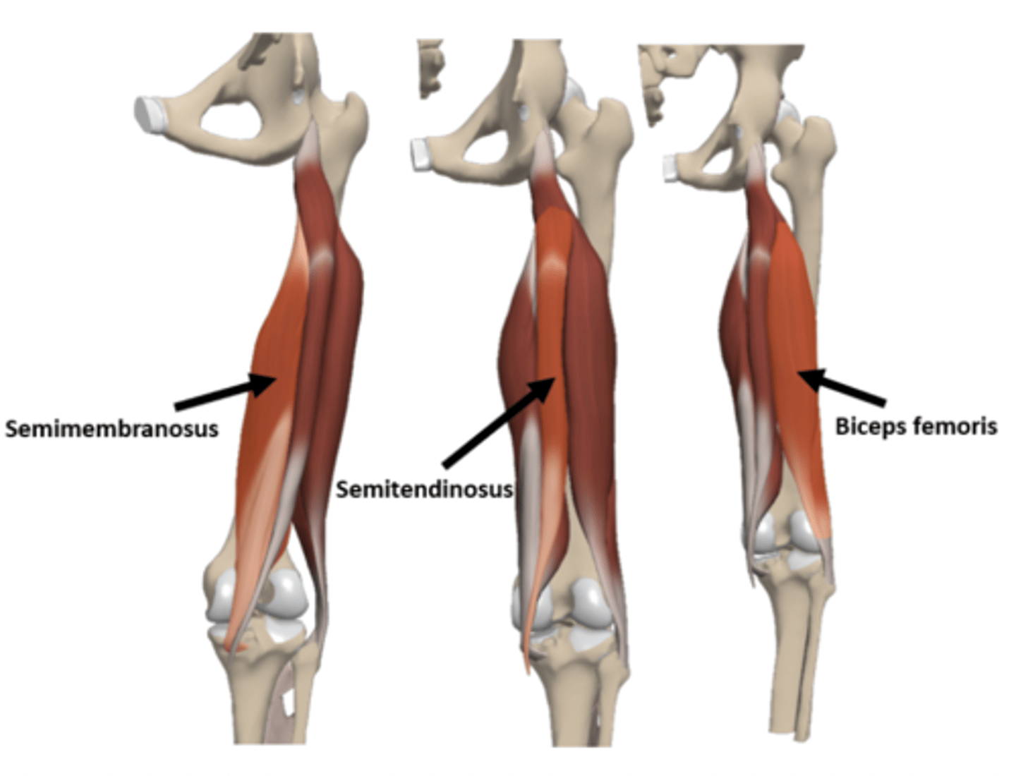 <p>Hamstring group: Biceps femoris, semitendinosus, and semimembranosus</p>