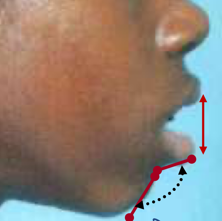 term image