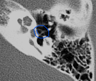 term image