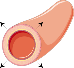 <p>Vasodilation</p>