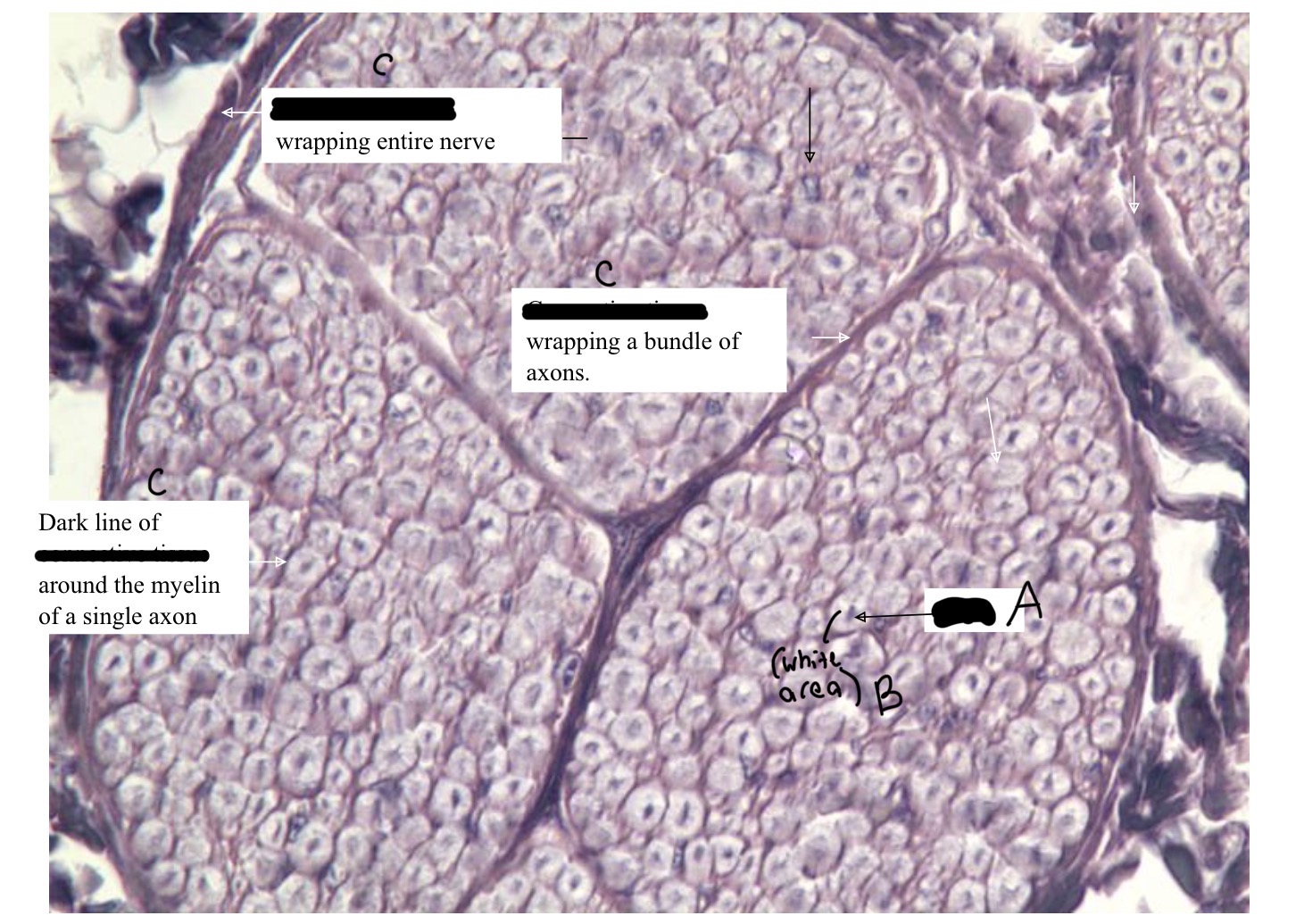 <p>Label This Myelinated Peripheral Nerve (cross section)</p>