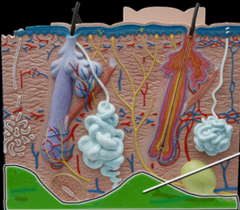 <p>deepest layer, from epidermis to dermis to hypodermis</p>