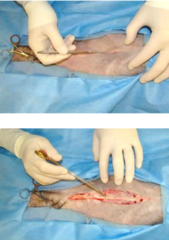 <p>There are pros and cons</p><ul><li><p>If you open the Linea alba there is no bleeding however it will take time to heal. </p><ul><li><p>There is less sensory innervation (less post-operative pain)</p></li><li><p>there is strong closure</p></li></ul></li></ul><p>- if you do a paramedian incision, you need a stronger suture and it is more painful, but it heals faster.</p>
