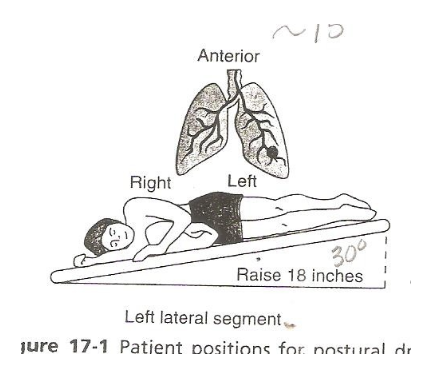 <p>left lateral segment anterior sidelayinbg</p>